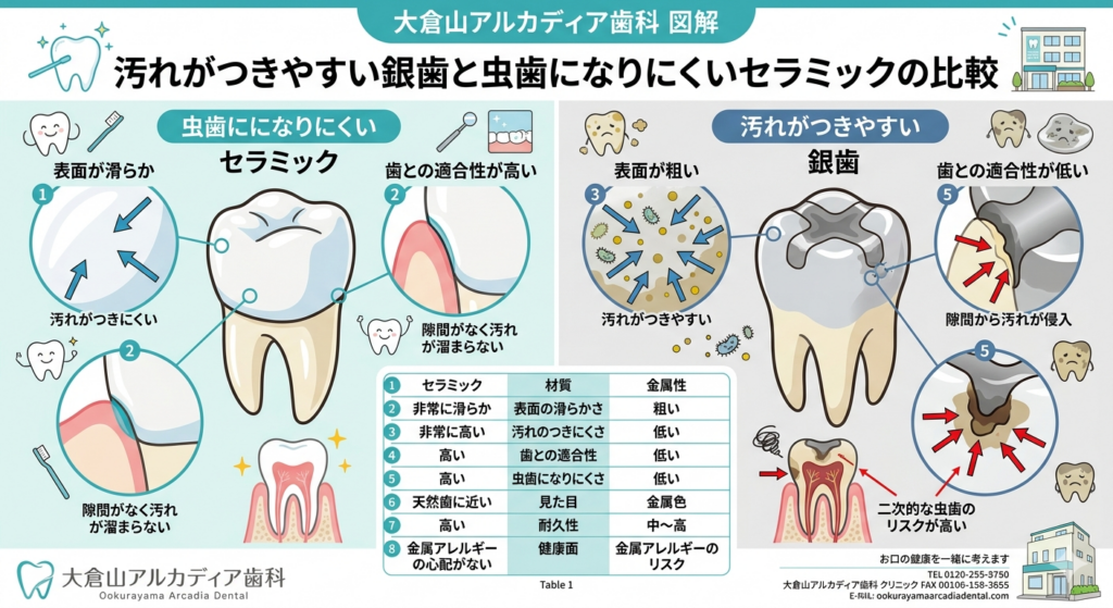 大倉山アルカディア歯科が図解。汚れがつきやすい銀歯と虫歯になりにくいセラミックの比較です。